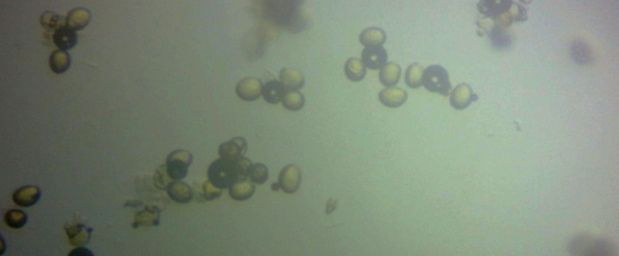 Pyłek śnieżyczki pod mikroskopem