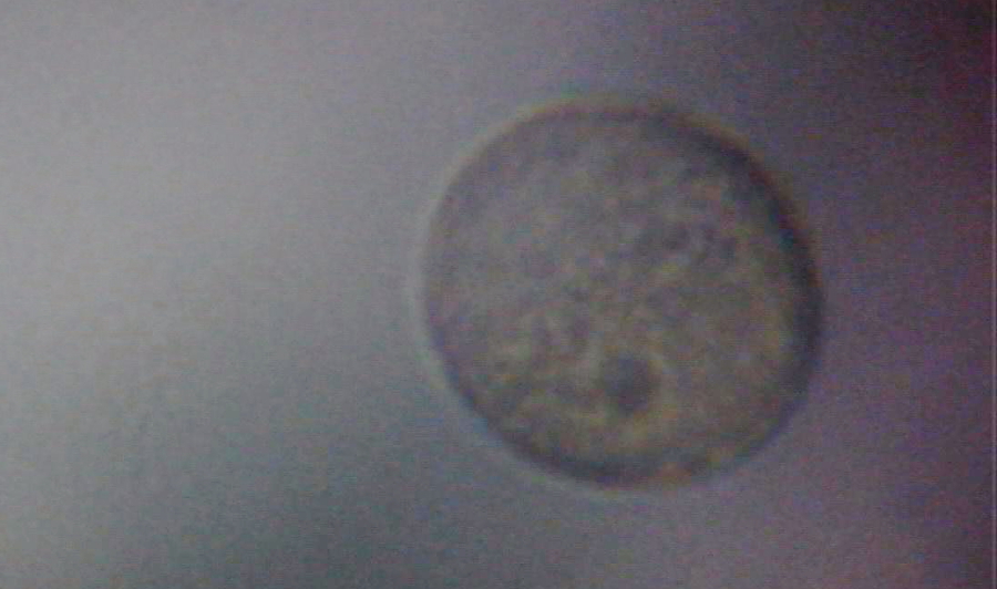 Pyłek wierzby iwy pod mikroskopem
